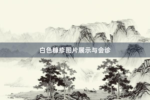 白色糠疹图片展示与会诊